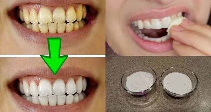 Отбеливайте свои желтые зубы менее чем за 2 минуты