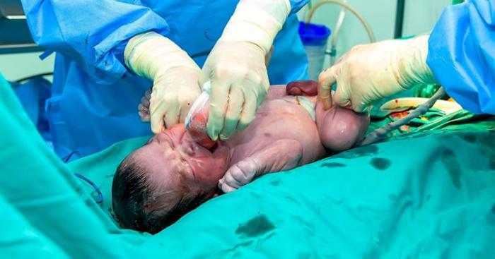 Когда врач увидел пуповину этого только младенца, он мгновенно взялся за камеру