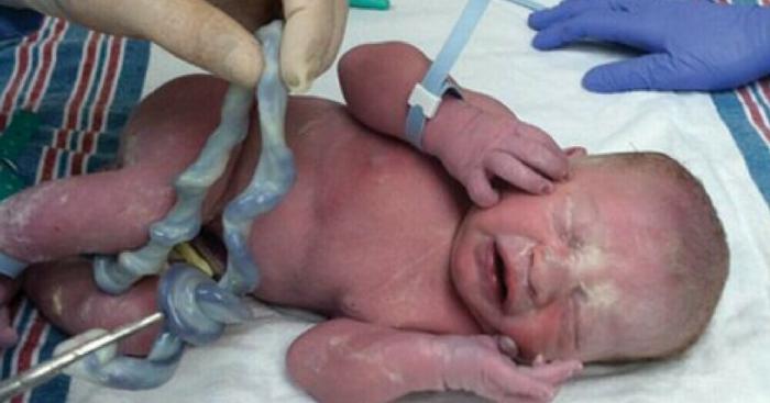 Когда врач увидел пуповину этого только младенца, он мгновенно взялся за камеру