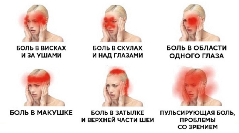 Врачи настоятельно говорят: какие виды головной боли нельзя терпеть, 6 типов