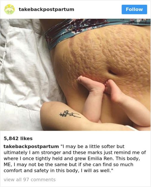 Честные фото послеродового тела: женщины показали то, о чем не говорят