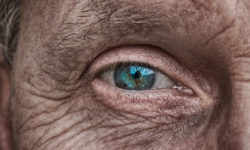 Гусиные лапки: что действительно помогает от морщин вокруг глаз