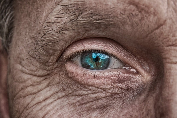 Гусиные лапки: что действительно помогает от морщин вокруг глаз