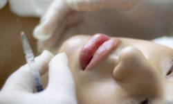 4 распространенных мифа об уколах в кожу лица